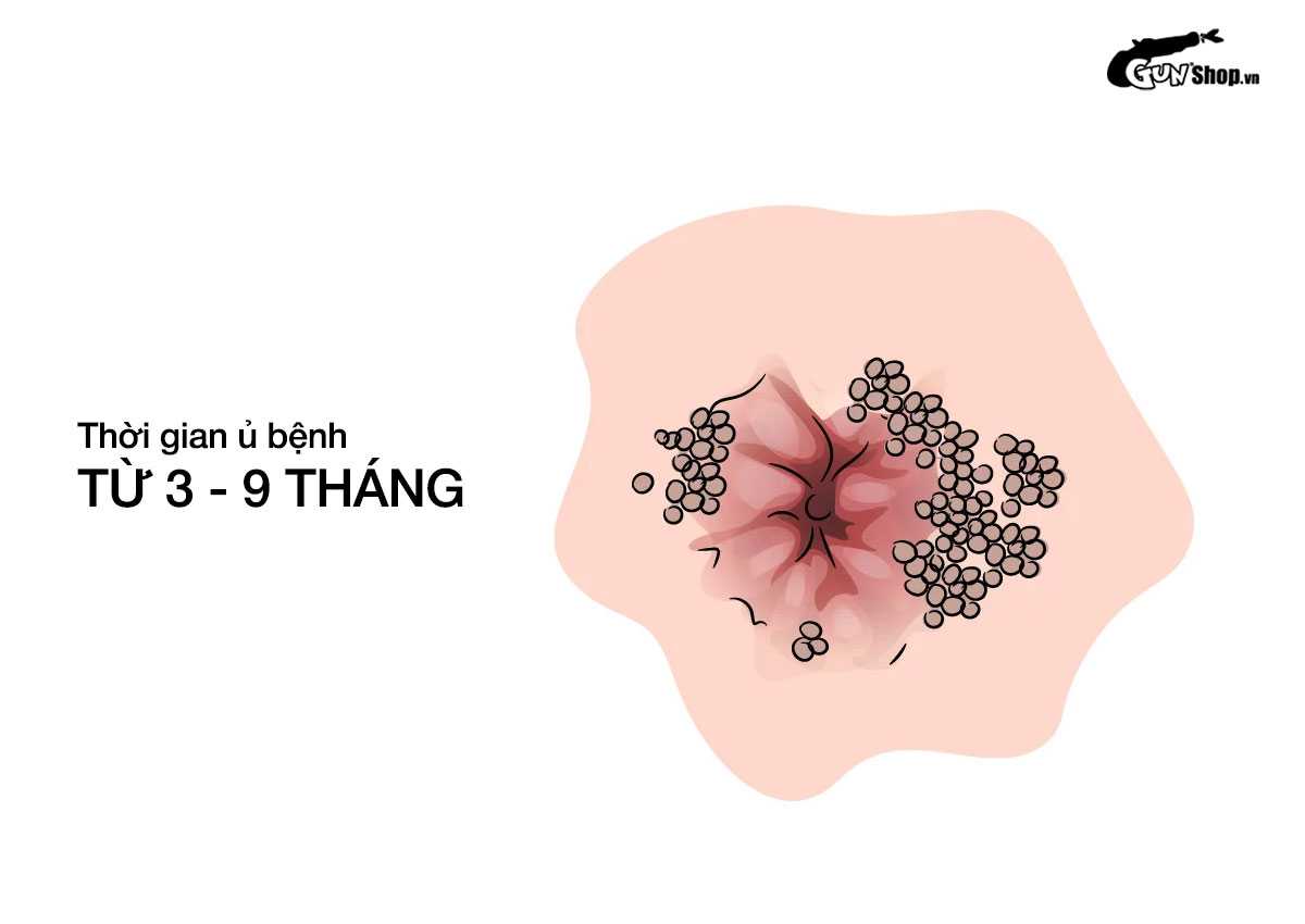 Ngủ chung có dễ lây sùi mào gà?
