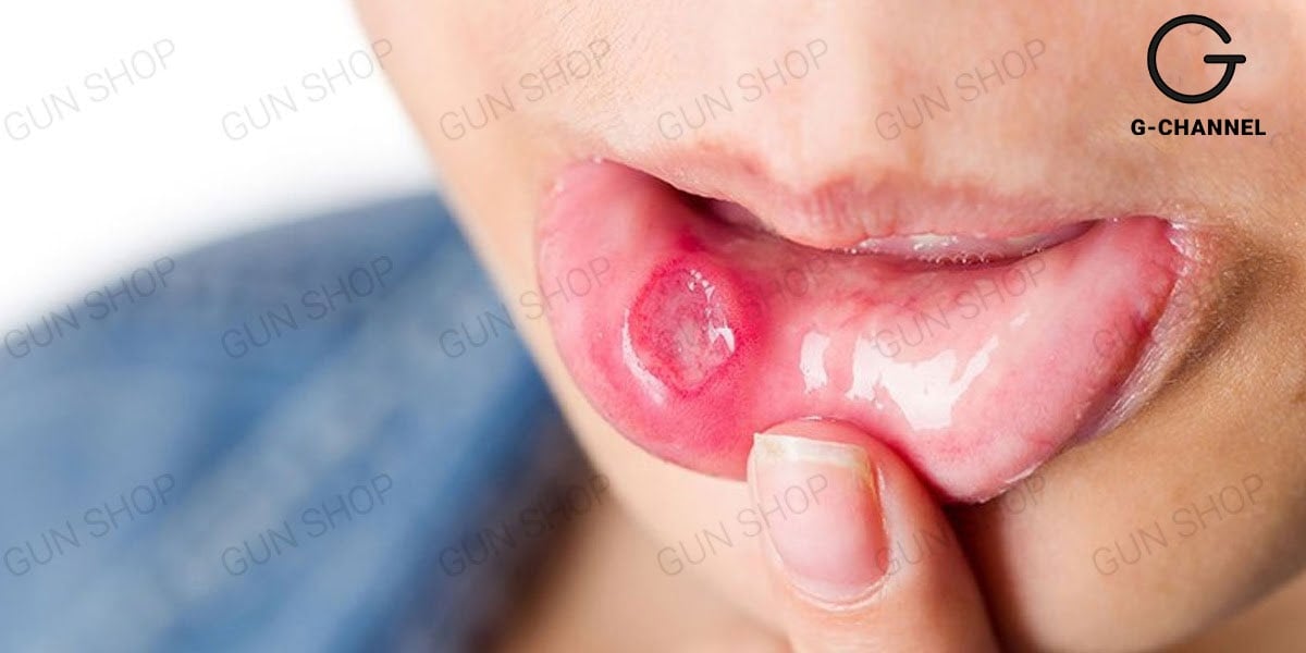 Quan hệ bằng miệng có nhiễm HIV không?