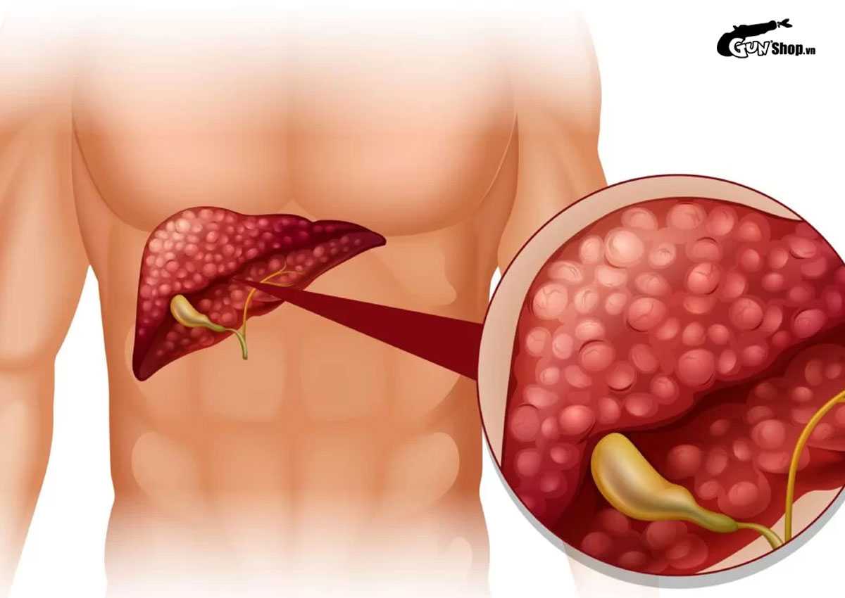 Cách quan hệ đồng giới nam không bị đau