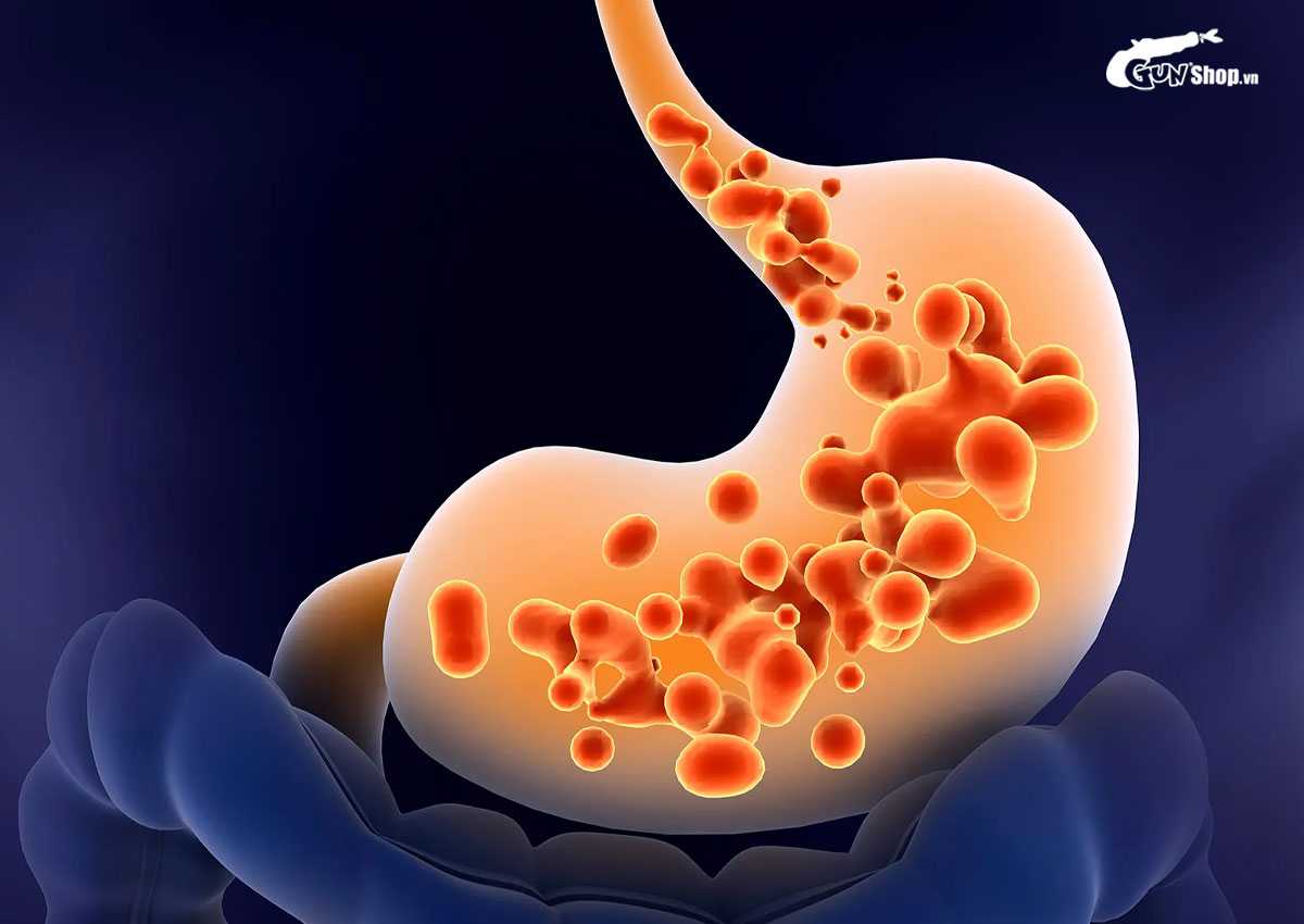 Ra mồ hôi trộm khi ngủ ở nam giới