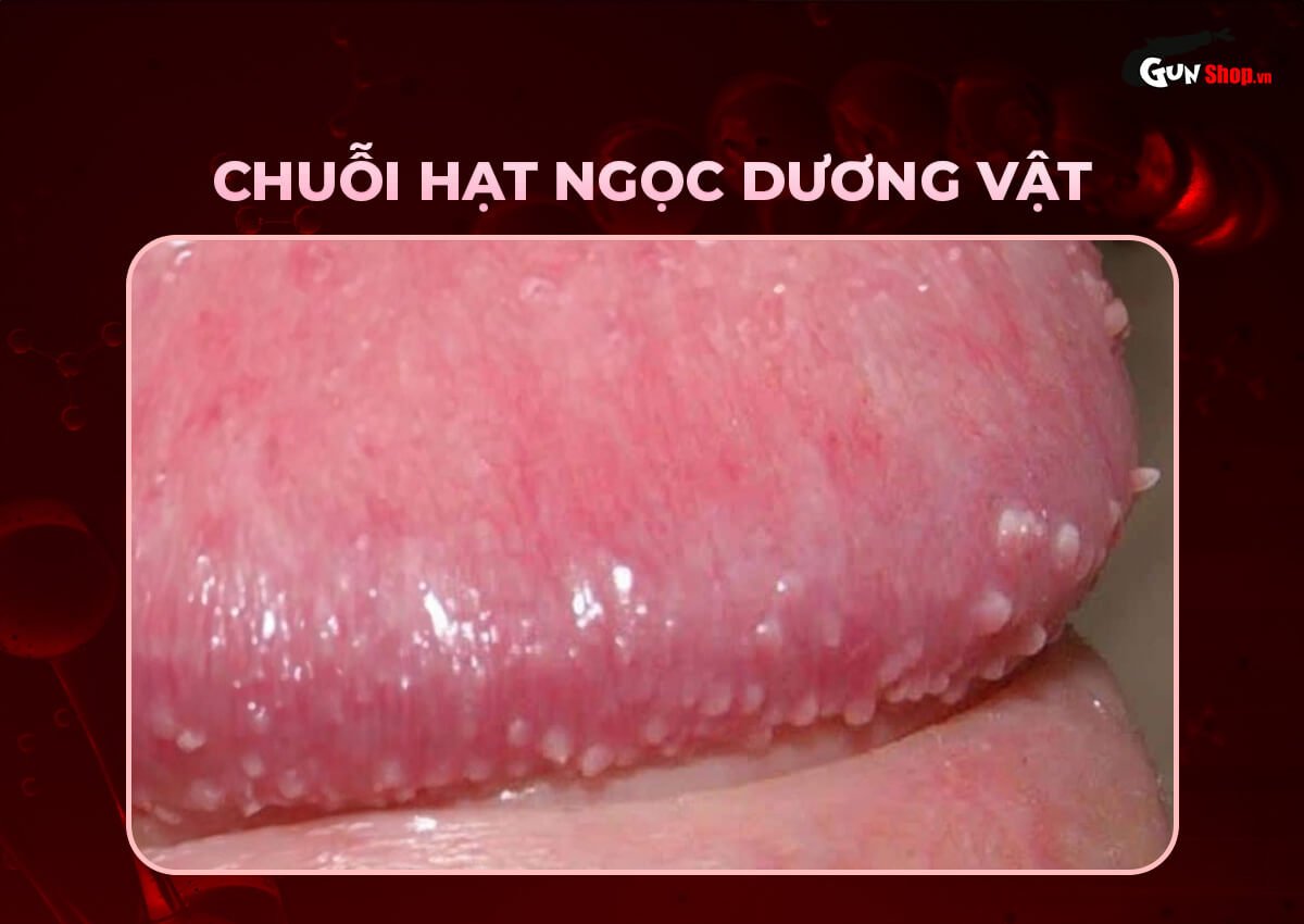 Rãnh bao quy đầu là gì?
