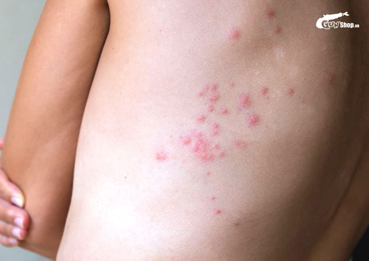 Rệp giường sợ mùi gì?