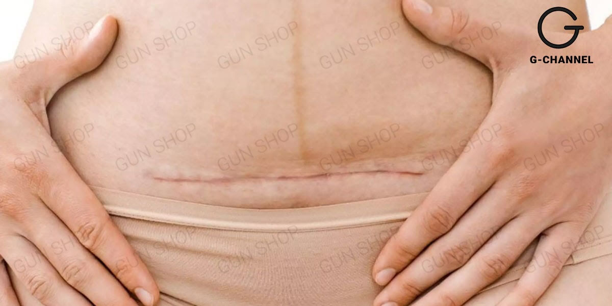 Tăng ham muốn sau sinh