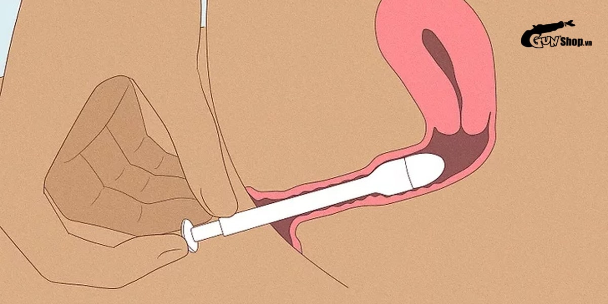 Cách sử dụng thuốc diệt tinh trùng