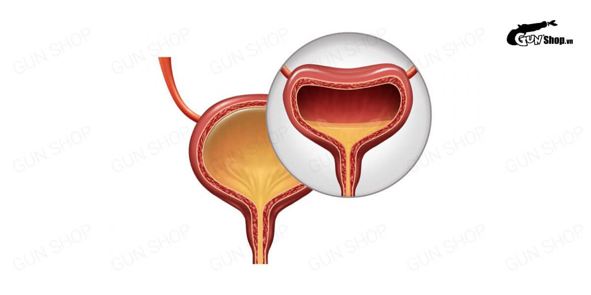 Tiểu không tự chủ nguyên nhân do đâu? Cách điều trị hiệu quả nhất