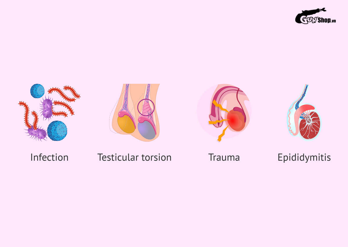 Nguyên nhân gây bệnh tràn dịch tinh hoàn là gì?