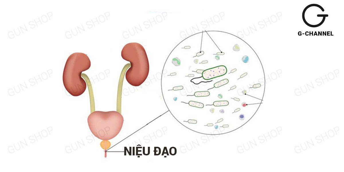 Tại sao tỷ lệ nữ giới bị viêm bàng quang cao hơn nam giới?