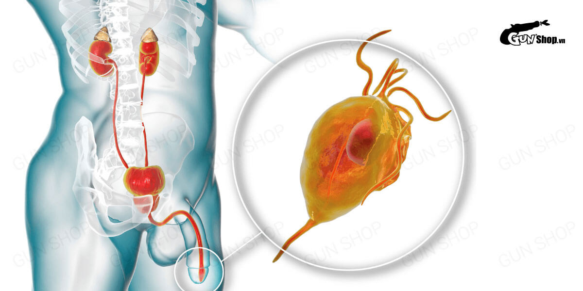 Viêm niệu đạo ở nam giới có biểu hiện gì? Nguy hiểm không? Có tự khỏi?