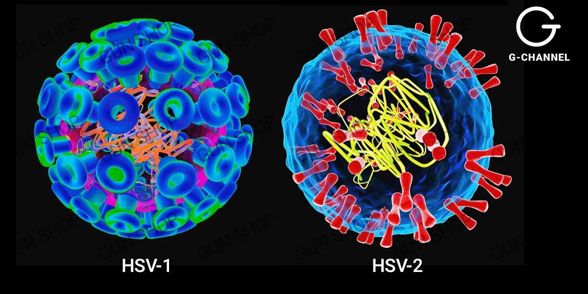 Virus Herpes là gì và bệnh Herpes có nguy hiểm không?