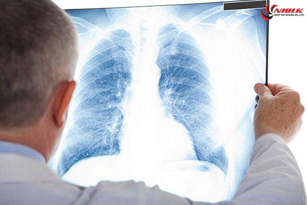 Lao phổi thuộc về nhóm bệnh hô hấp, bị cấm sang Nhật làm việc.
