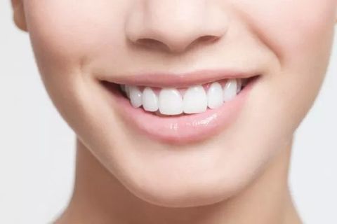 Mách bạn 7 cách ngăn ngừa cao răng hiệu quả