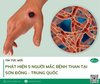 PHÁT HIỆN 5 NGƯỜI MẮC BỆNH THAN TẠI SƠN ĐÔNG - TRUNG QUỐC