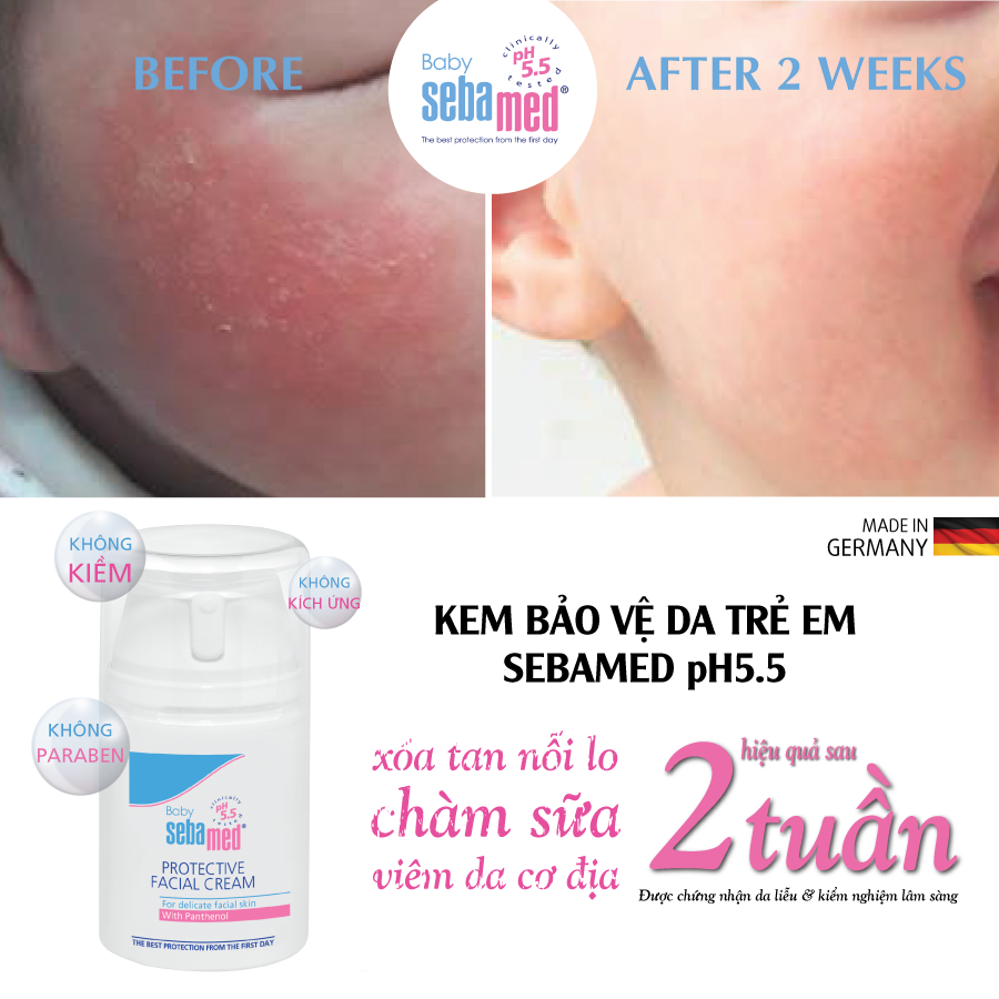 Kem Bảo Vệ Da Mặt, Ngăn Ngừa Chàm Sữa Sebamed Protective Facial Cream pH 5.5
