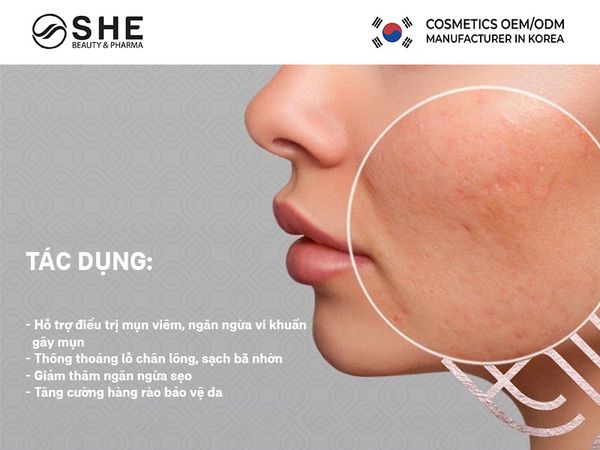 sản xuất kem trị mụn 2