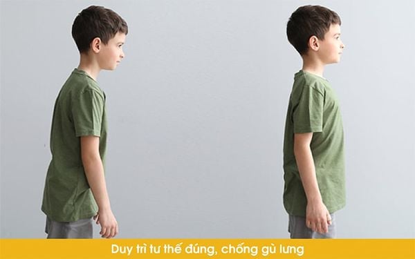 đặc điểm của balo chống gù