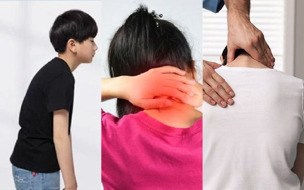 tổn thương cột sống do đeo balo không đúng cách
