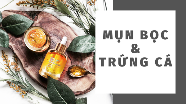 Bộ Đôi Hoàn Hảo Trị Mụn Bọc Và Mụn Trứng Cá