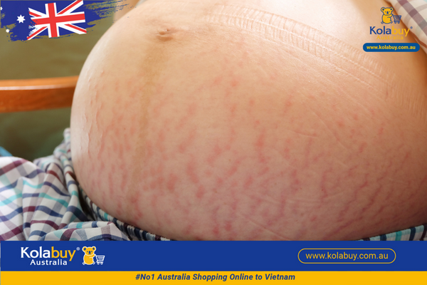 Tinh dầu chống rạn da Bio oil 125mL