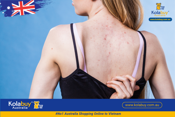 Tẩy da chết toàn thân Eaoron