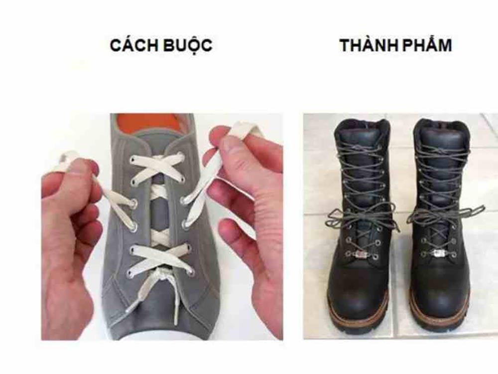 Chân Có Vòm Cao