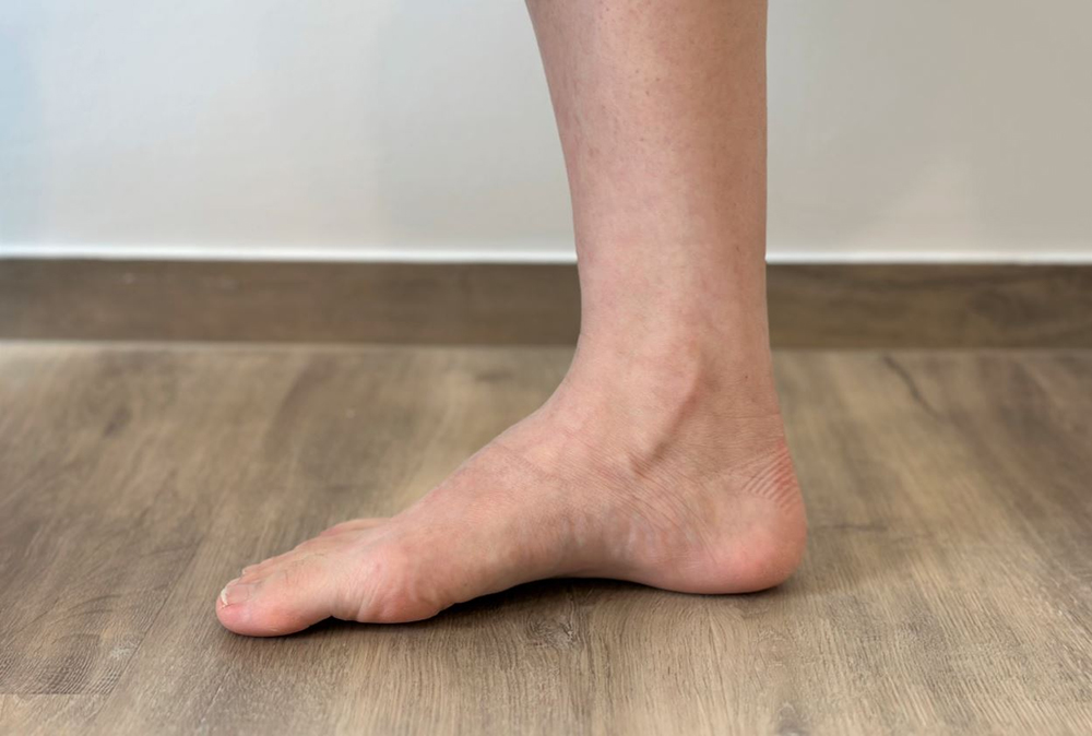 Cách buộc dây giày phù hợp với người có vòm chân cao