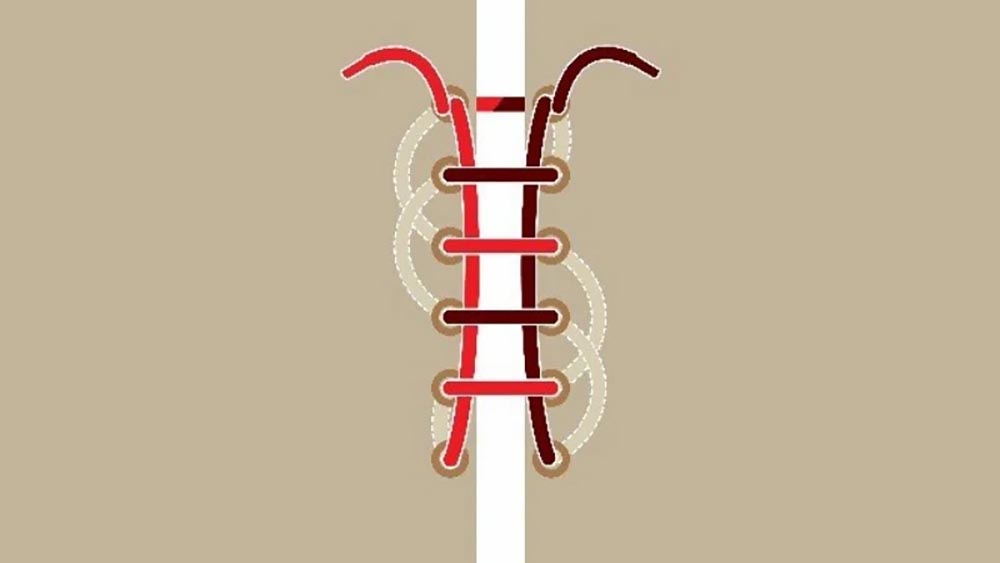 Ladder – Kiểu buộc dây dạng bậc thang