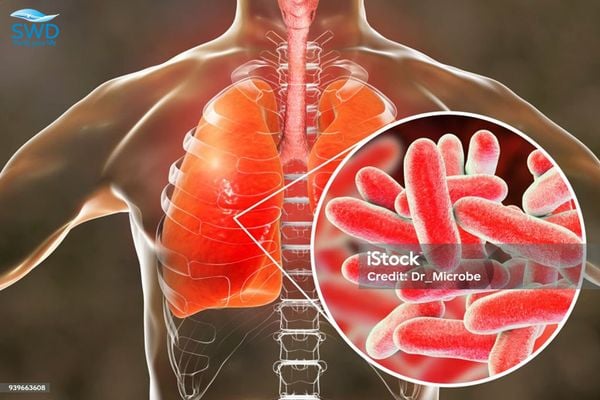 Vi khuẩn Legionella