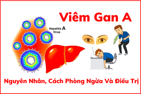 Viêm Gan A Là Gì? Nguyên Nhân, Triệu Chứng, Cách Phòng Ngừa Và Điều Trị