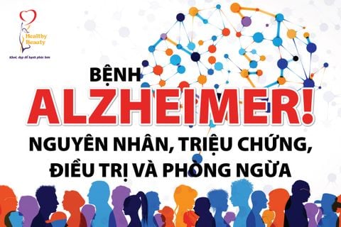 Bệnh Alzheimer: Nguyên Nhân, Triệu Chứng, Cách Điều Trị Và Phòng Ngừa