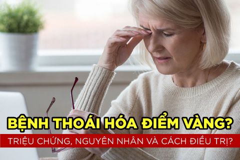 Bệnh Thoái Hóa Điểm Vàng? Triệu chứng, Nguyên Nhân và Cách Điều Trị?