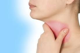 Nguyên nhân gây đau họng và cách phòng trị hiệu quả