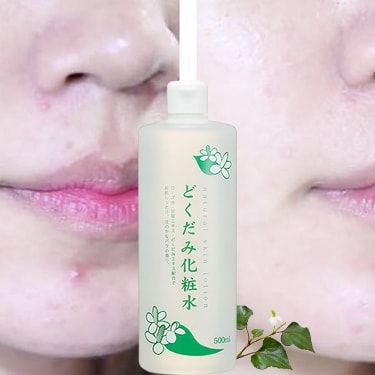 Nước Hoa Hồng Diếp Cá Dokudami Natural Skin Lotion - Lam Thảo Cosmetics