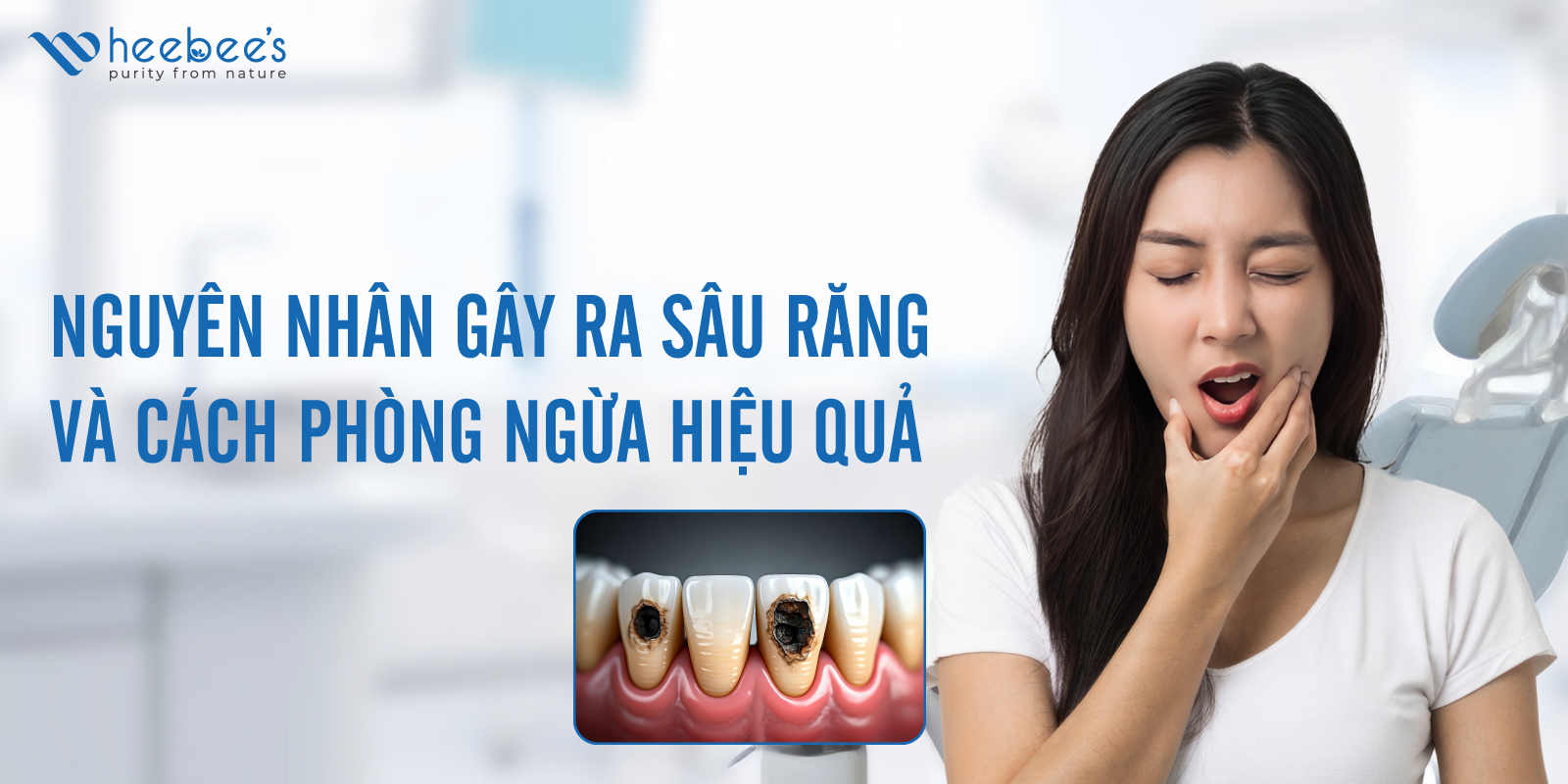 Nguyên Nhân Gây Ra Sâu Răng Và Biện Pháp Phòng Ngừa Hiệu Quả Nguyên Nhân Gây Ra Sâu Răng Và Biện Pháp Phòng Ngừa Hiệu Quả
