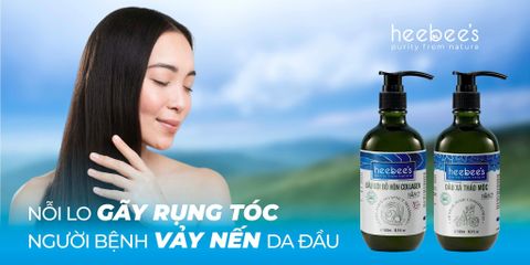 Nỗi Lo Gãy Rụng Tóc Người Bệnh Vảy Nến Da Đầu