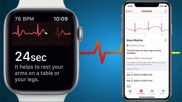 Apple Watch Series 4 với ứng dụng ECG nổi bật