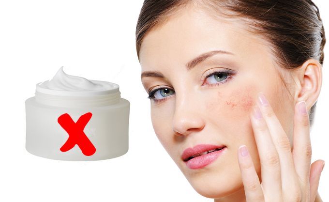 DẤU HIỆU DA NHIỄM CORTICOID - NHẬN BIẾT VÀ CÁCH XỬ LÝ