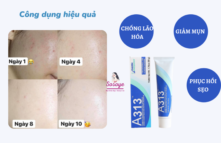 Kem Retinol A313 có gì