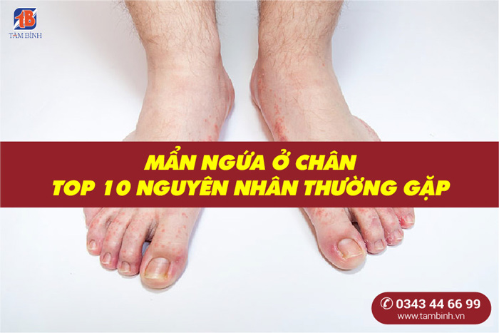 Cảnh Báo Về Nguy Cơ Dị Ứng Từ Việc Sử Dụng Bột Lá Không Rõ Nguồn Gốc