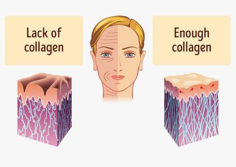 Collagen là gì? Tác dụng của Collagen đối với cơ thể người