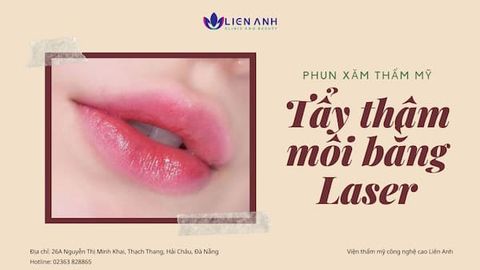 Tẩy môi thâm bằng công nghệ laser, khử thâm môi tại Đà Nẵng