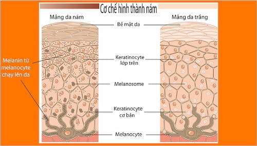 Melanin và cơ chế hình thành nám da, tàn nhang, đen da