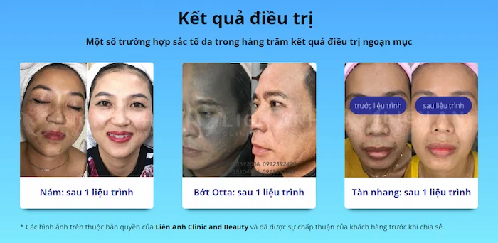 Tổng hợp spa đà nẵng uy tín chất lượng tốt nhất