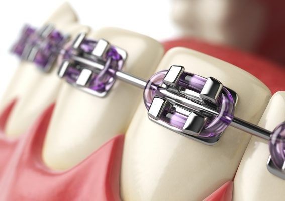 Orthodontic Treatment Home Dental Clinic