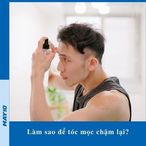 [Bật mí] Cách làm tóc mọc chậm lại hiệu quả nhất