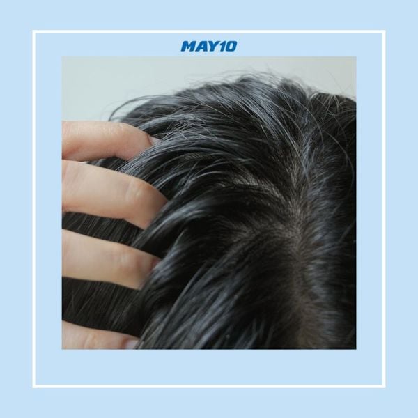 Bật mí 4 cách trị dứt điểm tóc bết từ nguyên liệu tự nhiên dễ làm