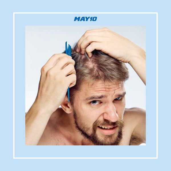 Tóc thưa ở đỉnh đầu nam điều trị như thế nào? – Be Nature Cosmetic