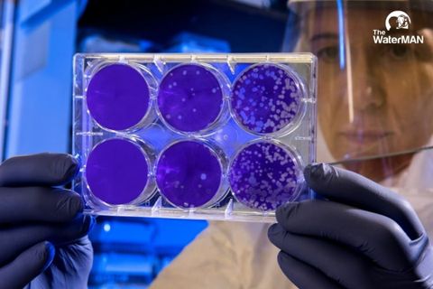 Kinh hãi trước tác hại của vi khuẩn coliform trong nước sinh hoạt