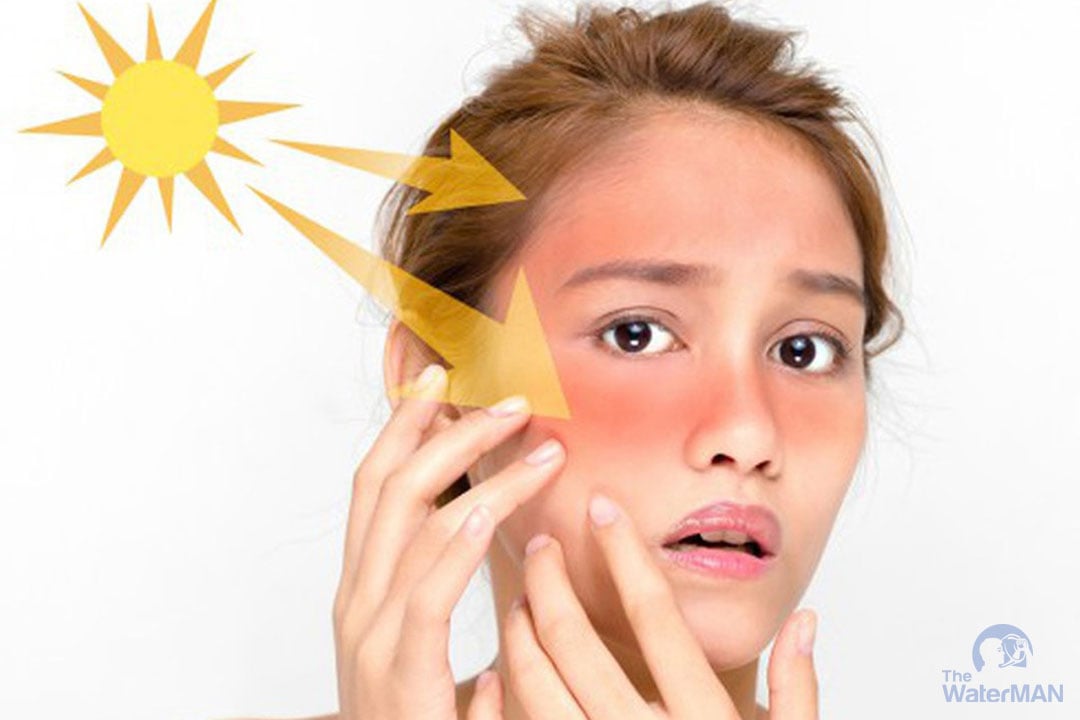 Kem chống nắng, kem dưỡng ẩm giúp da tránh những tác động trực tiếp từ ánh nắng mặt trời