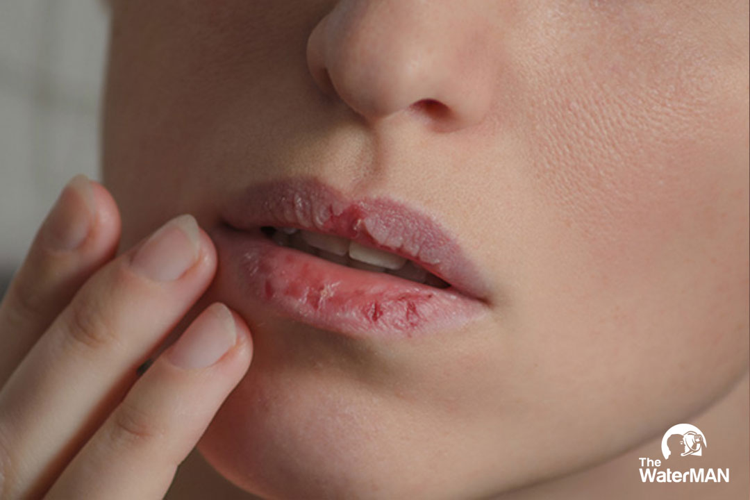 Khô môi có thể do cơ thể thiếu vitamin, dư đường trong máu, bệnh răng miệng.