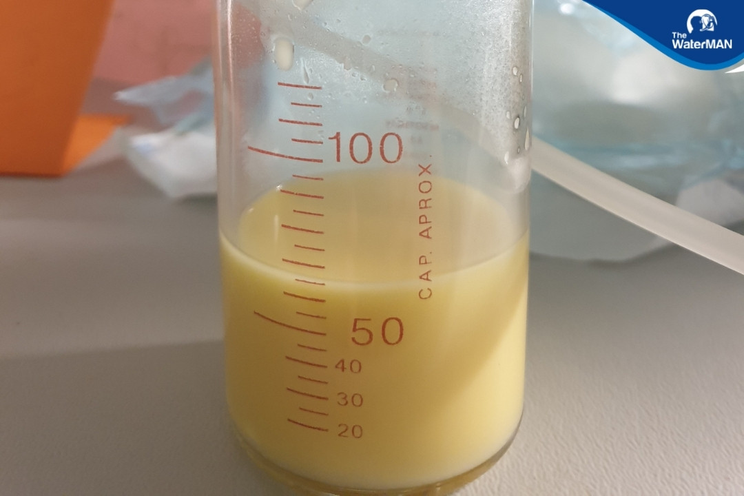 Sữa non thường có màu vàng đục, độ dính cao hơn sữa thông thường